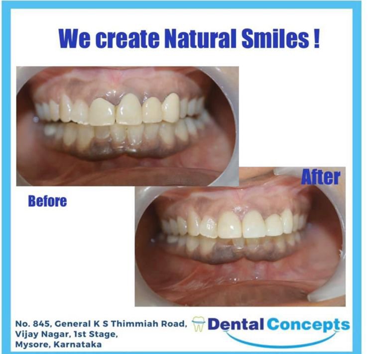Dental treatment case photograph 28