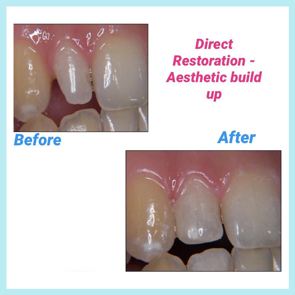 Dental treatment case photograph 11