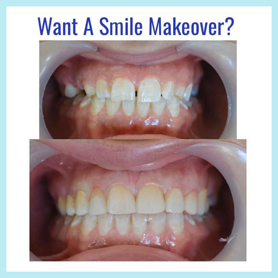 Dental treatment case photograph 12