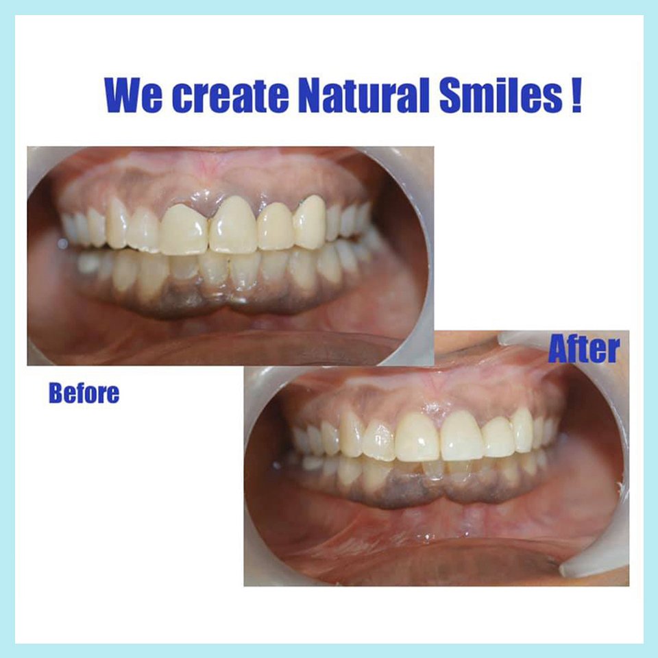 Dental treatment case photograph 13
