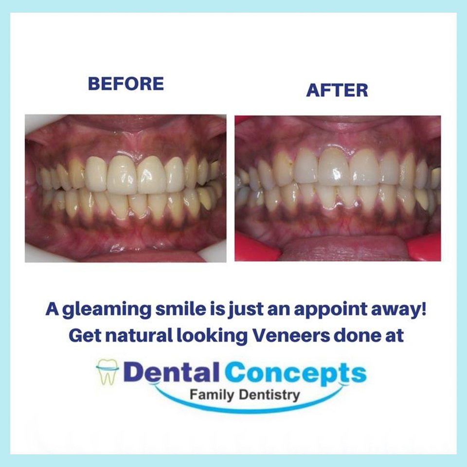 Dental treatment case photograph 10
