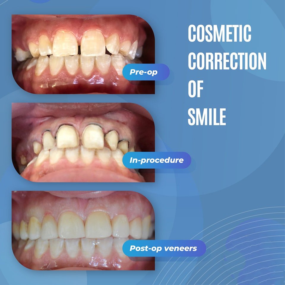 Dental treatment case photograph 1