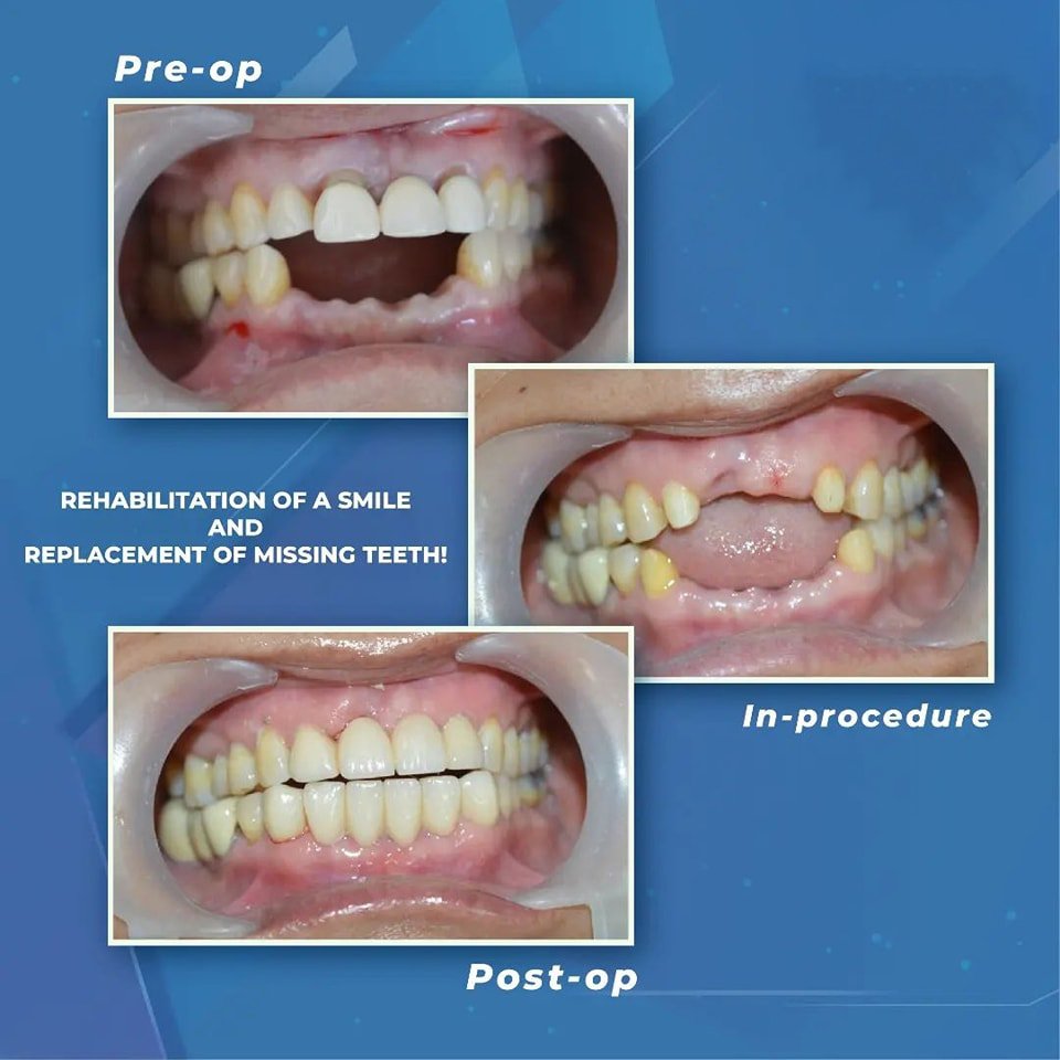 Dental treatment case photograph 2