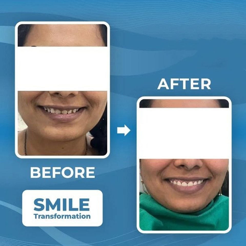 Dental treatment case photograph 3