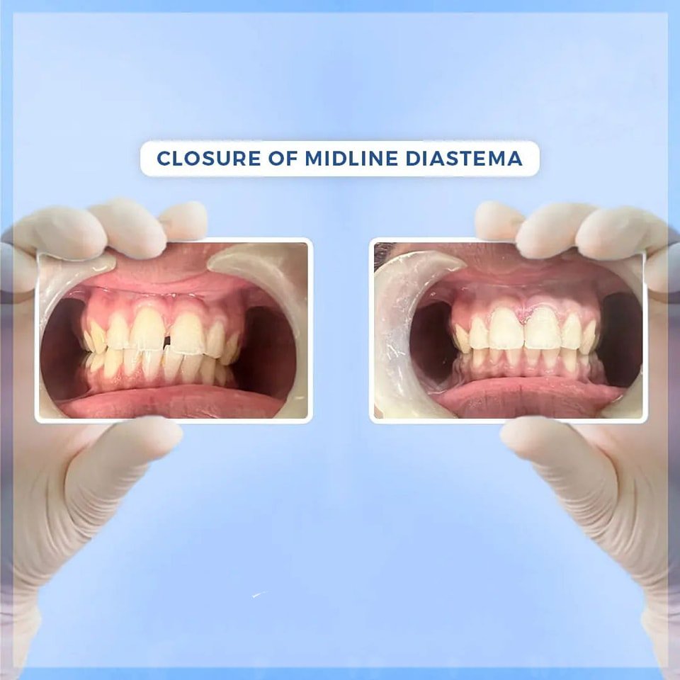 Dental treatment case photograph 4