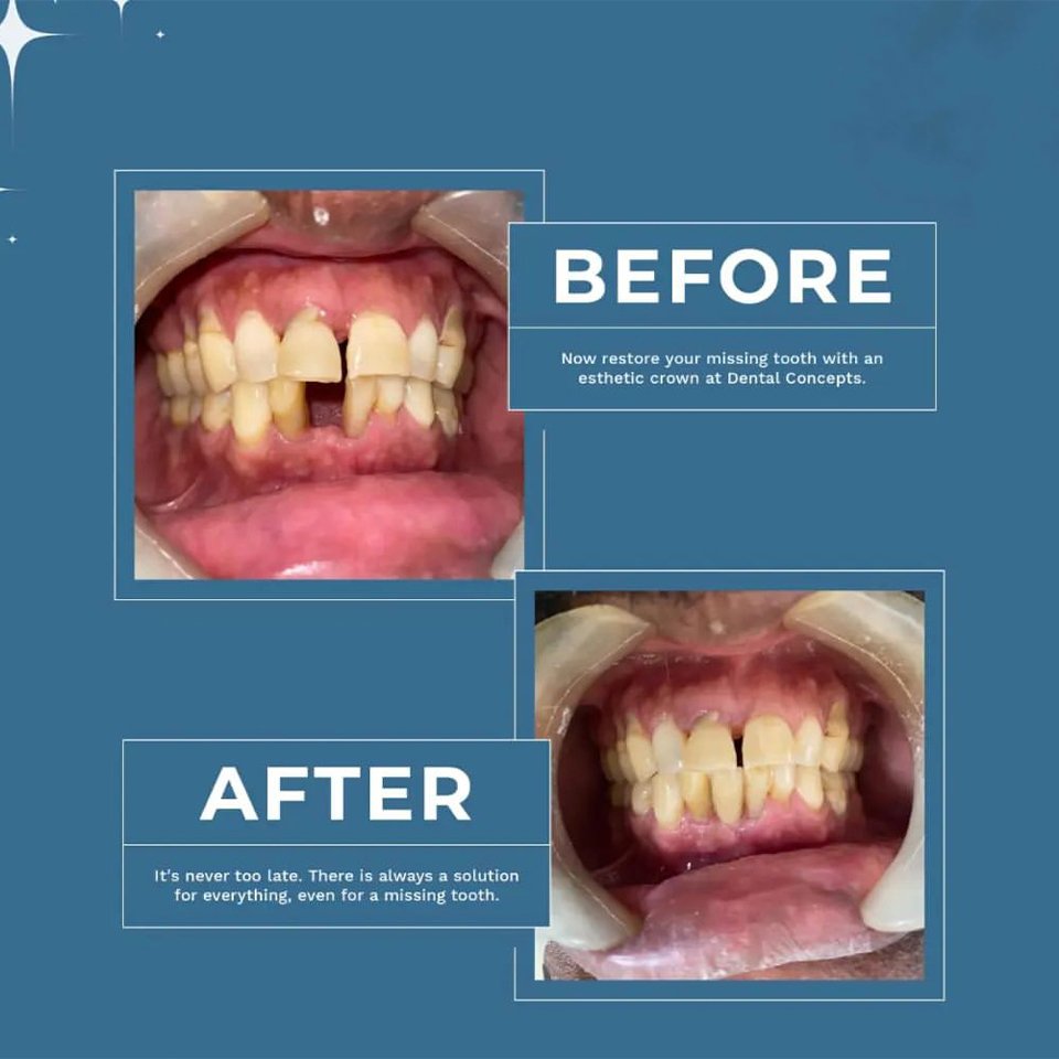 Dental treatment case photograph 5