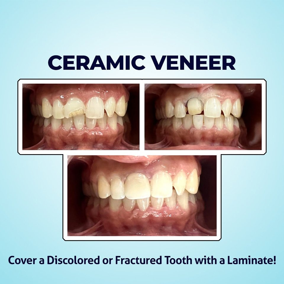 Dental treatment case photograph 6