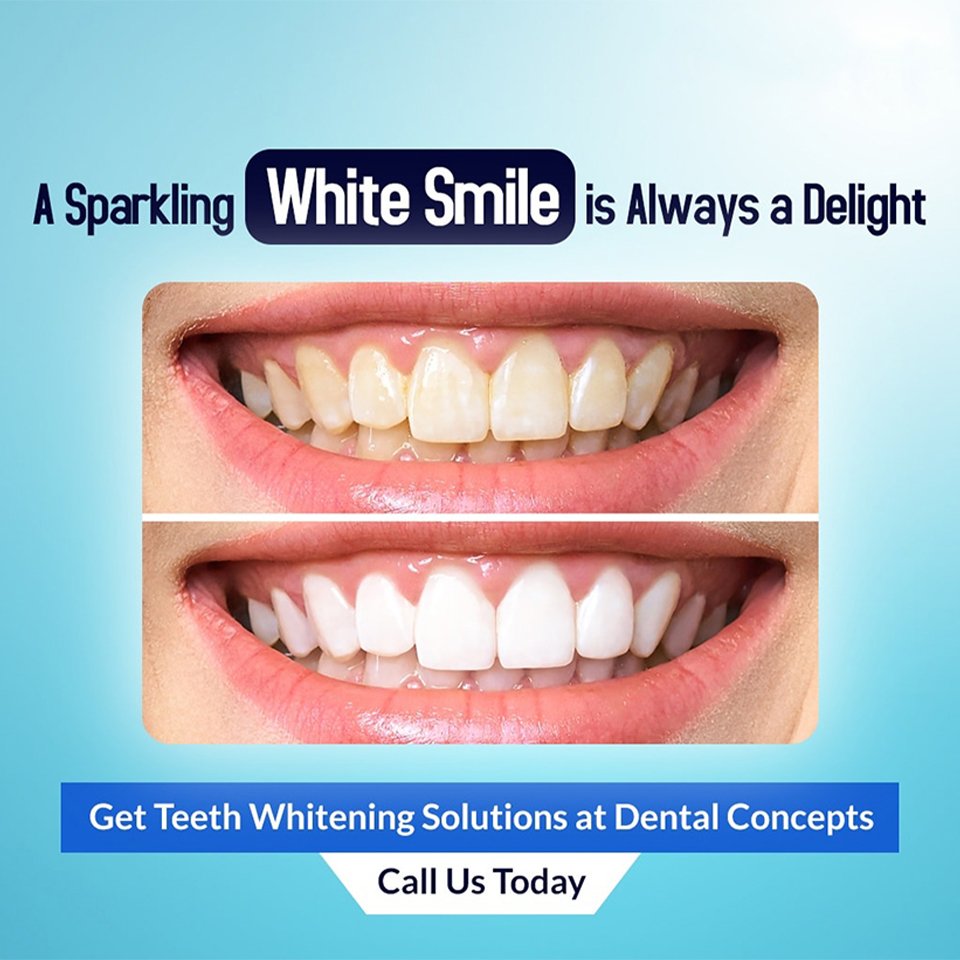 Dental treatment case photograph 7