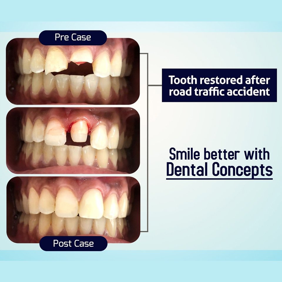 Dental treatment case photograph 8