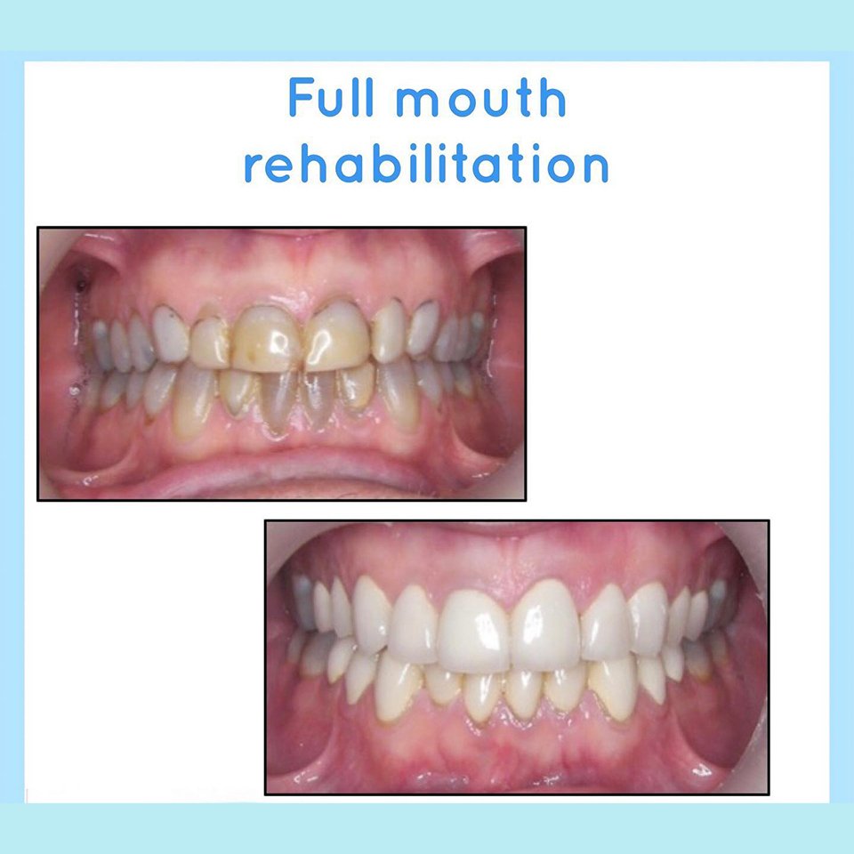 Dental treatment case photograph 9