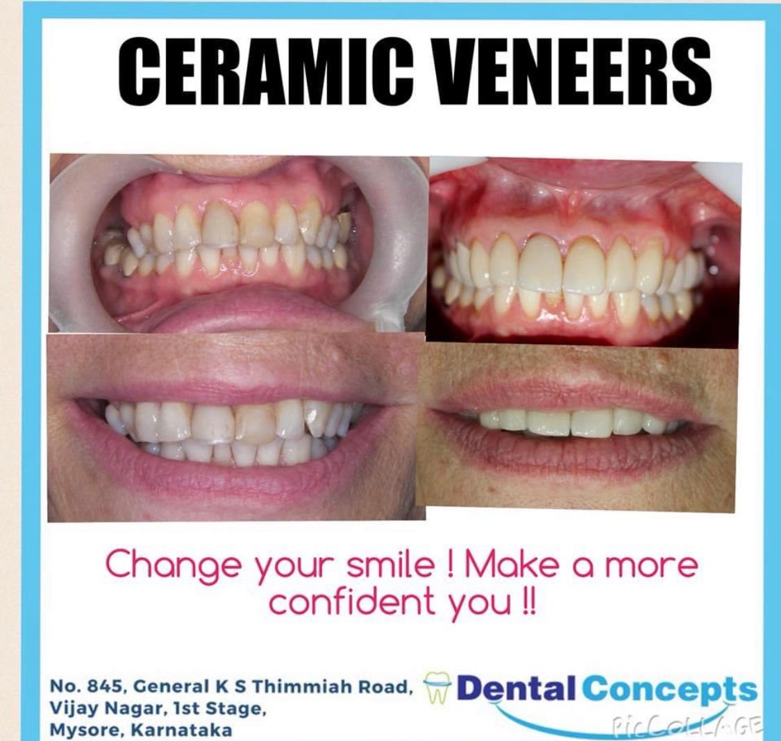 Dental treatment case photograph 14