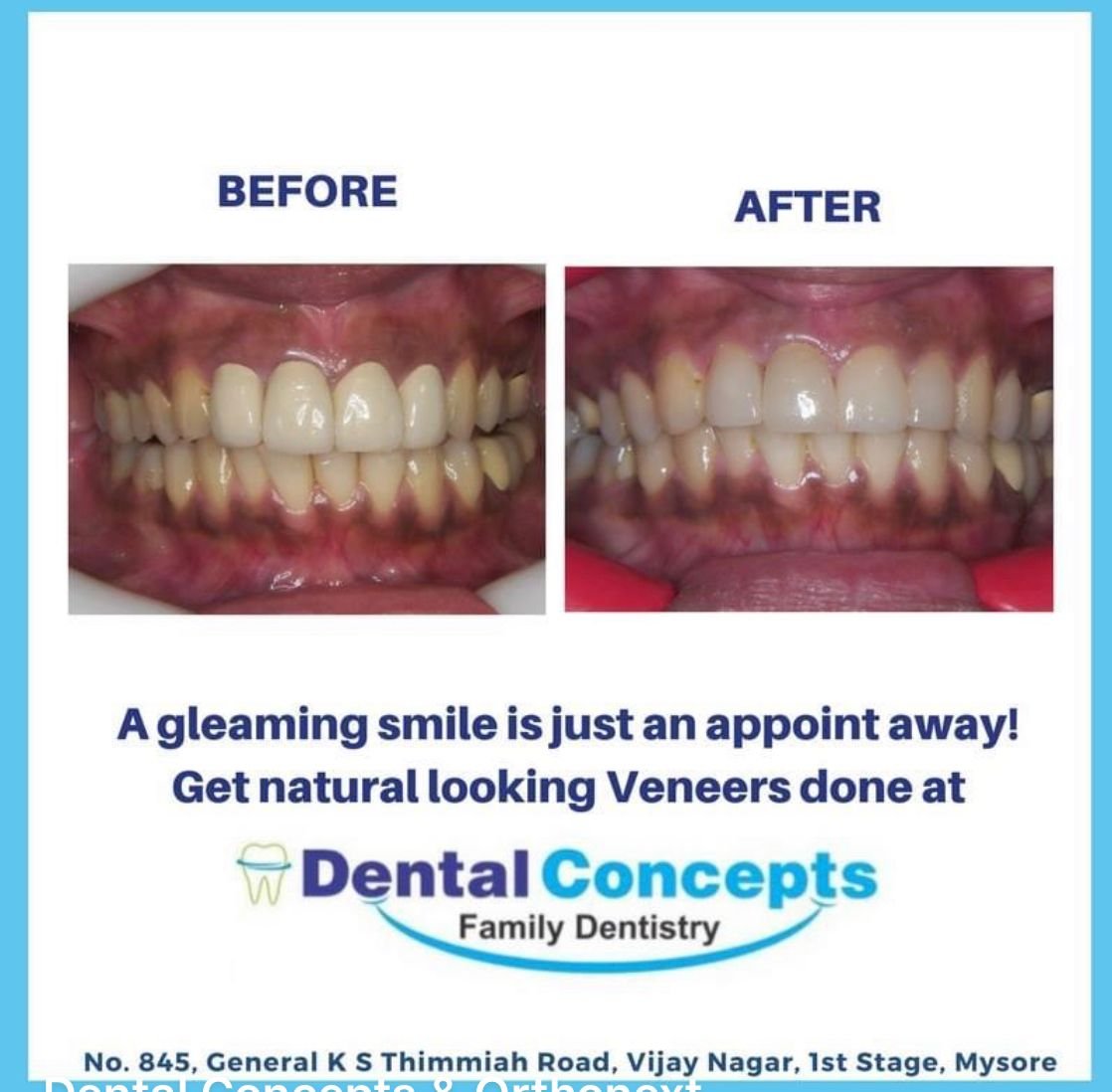 Dental treatment case photograph 15