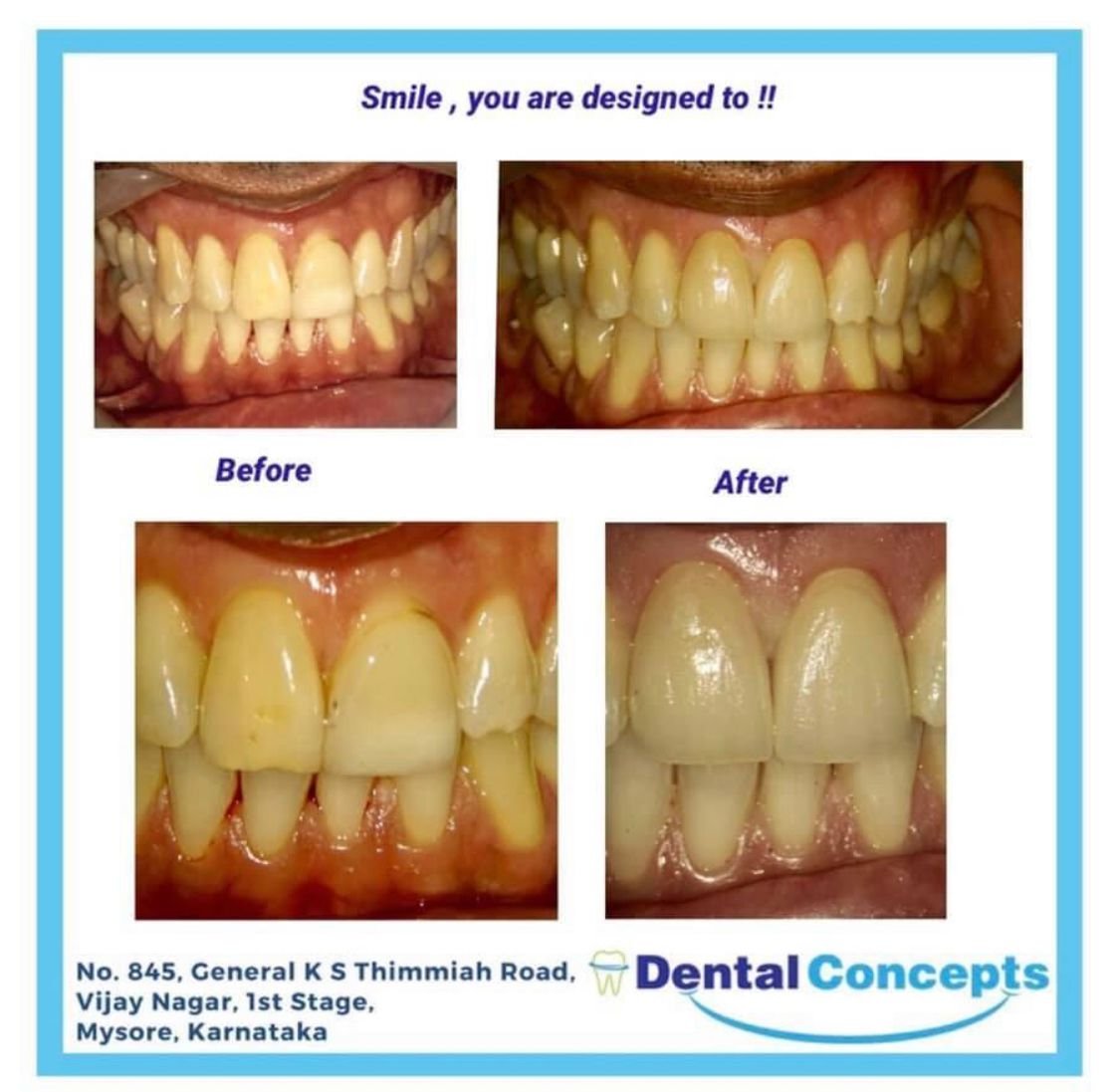 Dental treatment case photograph 16