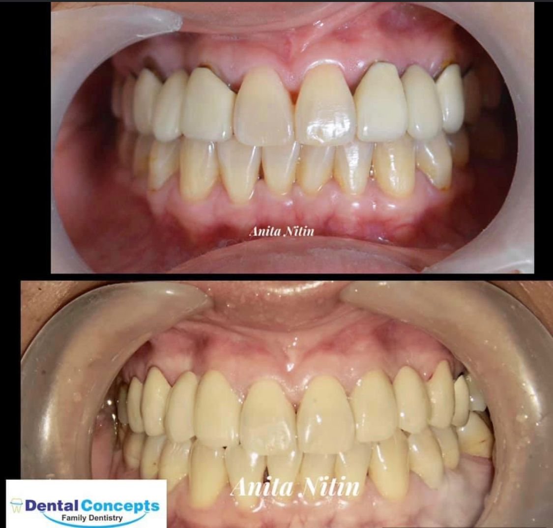 Dental treatment case photograph 17
