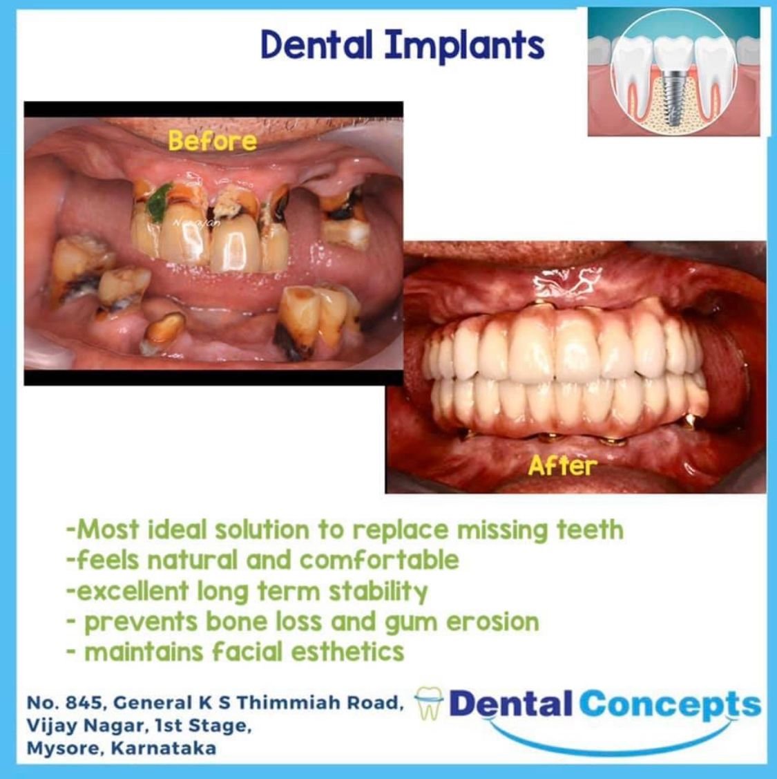 Dental treatment case photograph 18