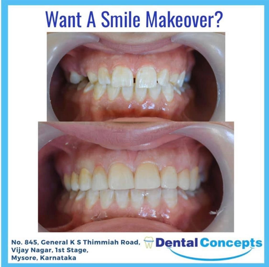 Dental treatment case photograph 19