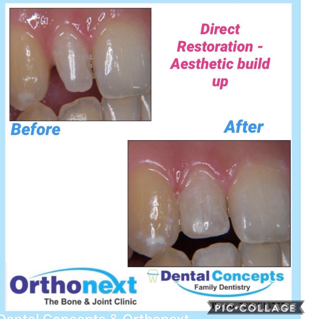 Dental treatment case photograph 20