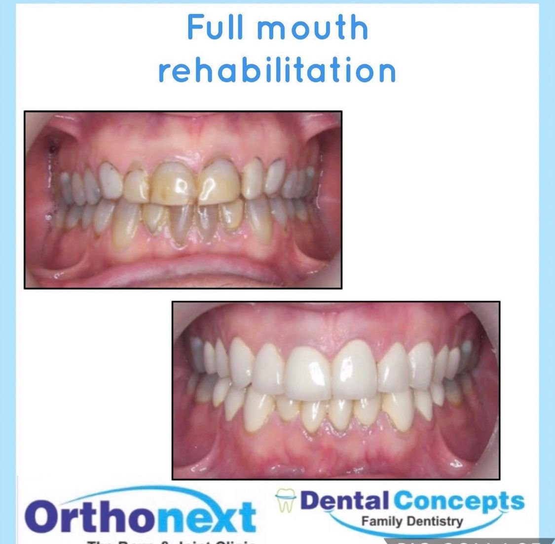 Dental treatment case photograph 21