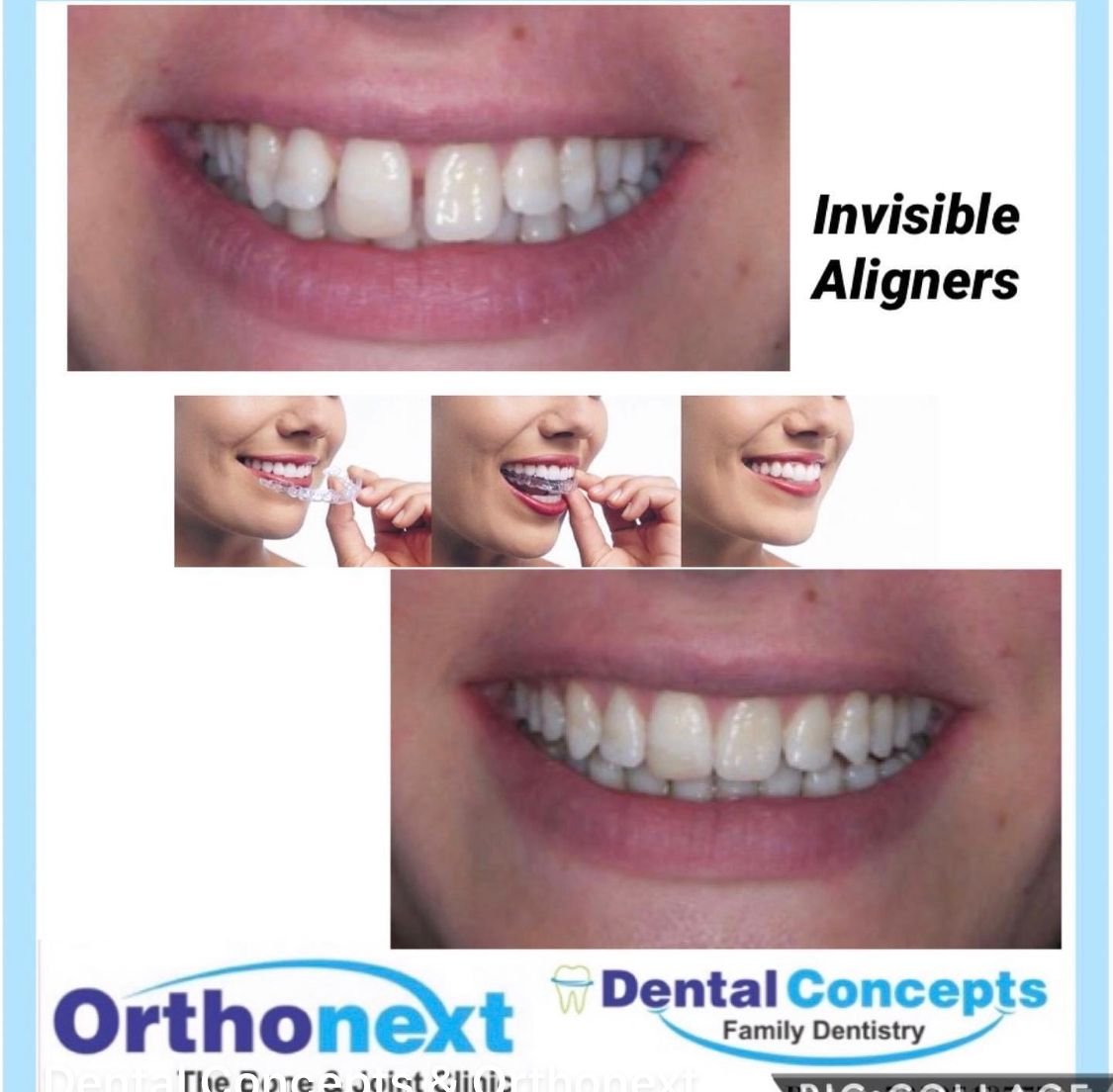 Dental treatment case photograph 22