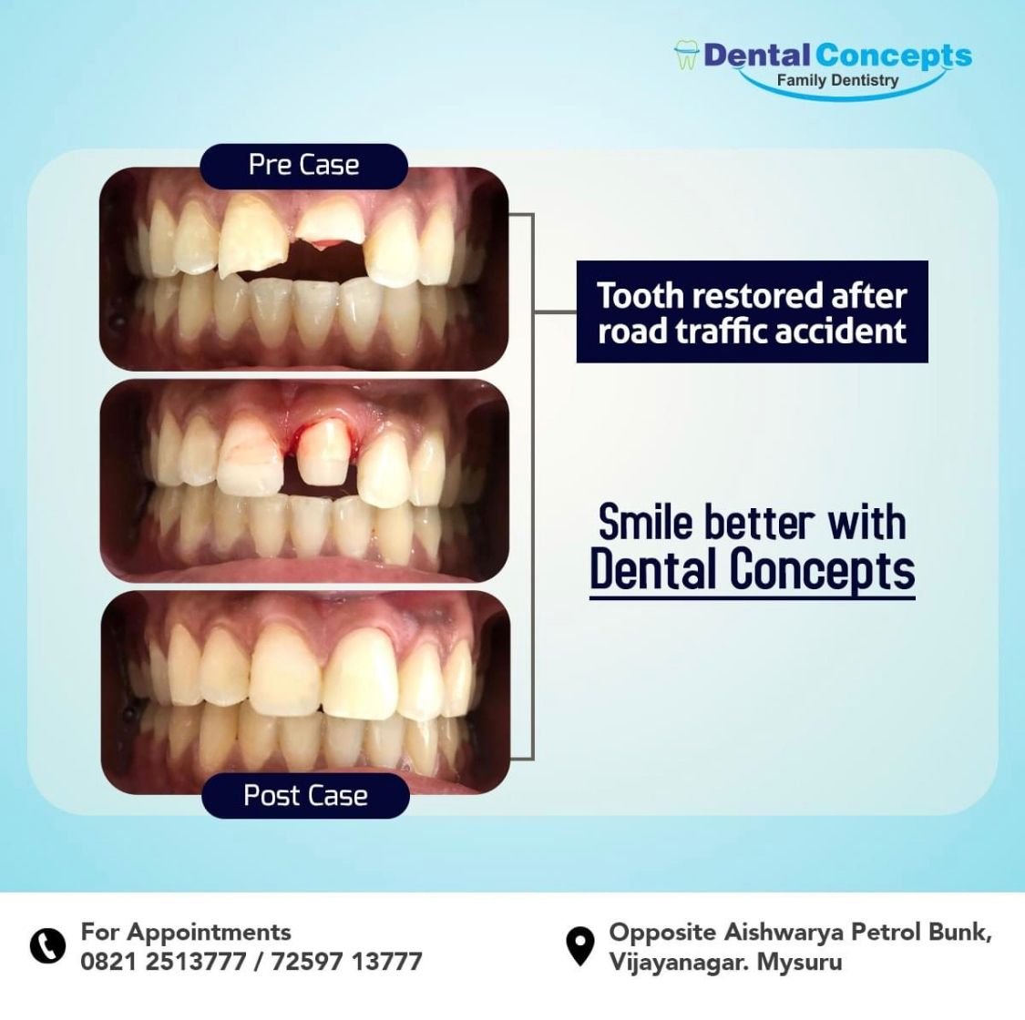 Dental treatment case photograph 23
