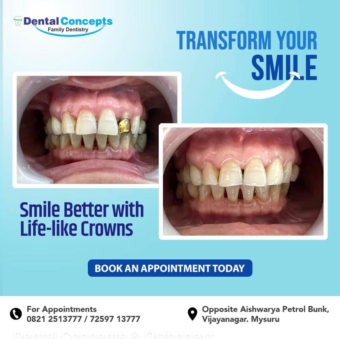 Dental treatment case photograph 25