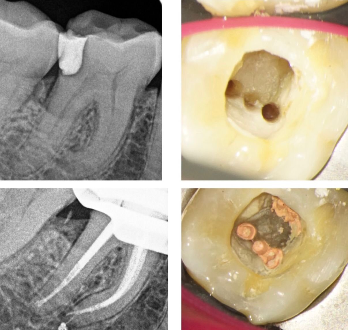 Dental treatment case photograph 26