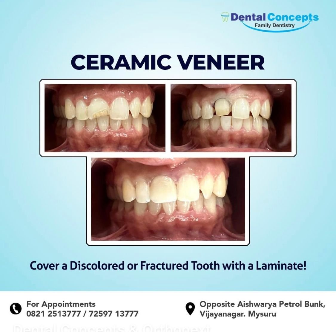 Dental treatment case photograph 27